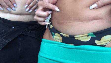 Scar below the fat belly d