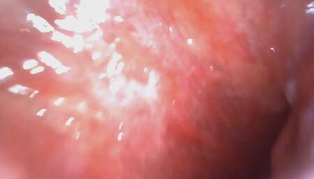 The Neighbors Throat