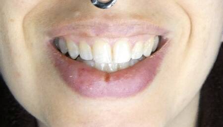 Open Mouth Vape Exhale Lots of Smoke and Teeth!