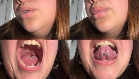 Saliva bubbles, very wet mouth