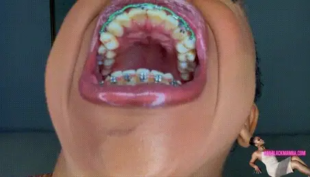 Dental Fetish Porn - Dentist Fetish Porn Videos (6) - FAPSTER