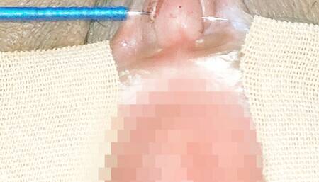 No audio. It's been a while since a needle was inserted through the clitoris.