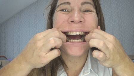 Look at my mouth and teeth so close tf