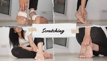 I scratch myself with and without sandals!