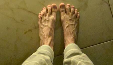 So swollen veins on the feet