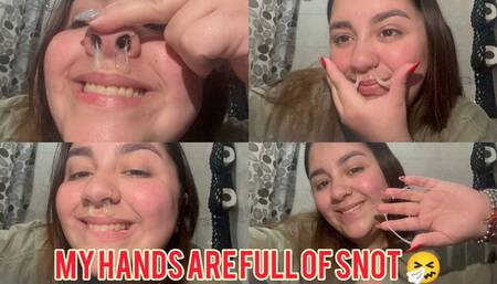 My hands are full of snot