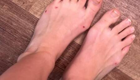 Dominated by Ugly Dancer Feet